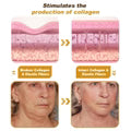 Bee Venom Wrinkle Repair Cream š