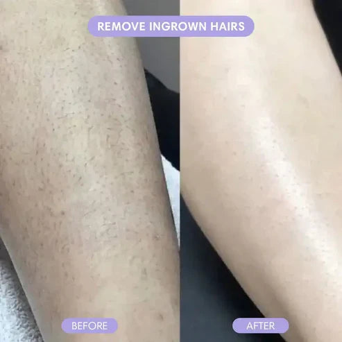 Homhaven™ Crystal Hair Remover